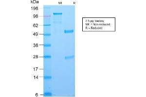 SDS-PAGE Analysis Purified BCL-6 Rabbit Recombinant Monoclonal Antibody (BCL6/2497R). (Recombinant BCL6 anticorps  (AA 256-389))