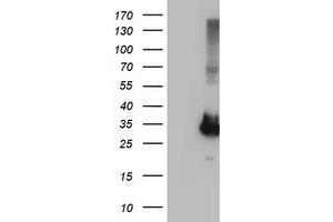 Image no. 1 for anti-Phenylethanolamine N-Methyltransferase (PNMT) antibody (ABIN1500316) (PNMT anticorps)