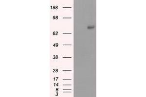 Western Blotting (WB) image for anti-Protein Kinase, CGMP-Dependent, Type I (PRKG1) antibody (ABIN1500243)
