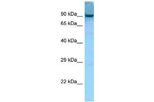WB Suggested Anti-Aacs Antibody Titration: 1. (AACS anticorps  (Middle Region))