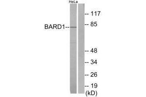 Western blot analysis of extracts from HeLa cells, using BARD1 antibody. (BARD1 anticorps  (N-Term))