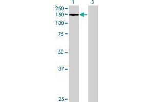 Lane 1: EP400 transfected lysate ( 108.