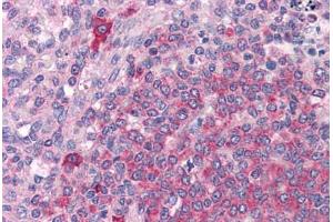 Human Spleen: Formalin-Fixed, Paraffin-Embedded (FFPE)