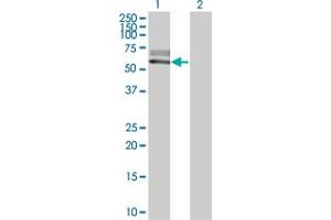 Western Blot analysis of ACVRL1 expression in transfected 293T cell line by ACVRL1 monoclonal antibody (M06), clone 2C12. (ACVRL1 anticorps  (AA 22-119))