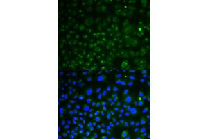 Immunofluorescence analysis of HeLa cells using LAMP1 antibody (ABIN5998110). (LAMP1 anticorps)