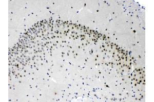 PSMA3 was detected in paraffin-embedded sections of rat brain tissues using rabbit anti- PSMA3 Antigen Affinity purified polyclonal antibody (Catalog # ) at 1 µg/mL.