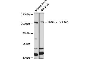 Western blot analysis of extracts of various cell lines, using TGN46/TGN46/TGOLN2 antibody (ABIN7270876) at 1:1000 dilution. (TGOLN2 anticorps)