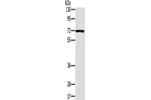 Western Blotting (WB) image for anti-Plastin 3 (PLS3) antibody (ABIN2423979) (Plastin 3 anticorps)