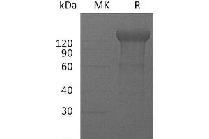 Western Blotting (WB) image for Interleukin 12 Receptor, beta 2 (IL12RB2) protein (Fc Tag) (ABIN7320555)