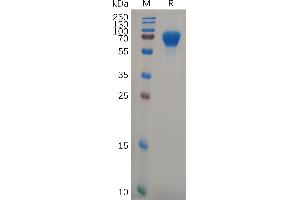 Human GP6 Protein, hFc Tag on SDS-PAGE under reducing condition.