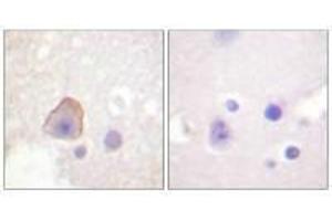 Immunohistochemical analysis of paraffin-embedded human brain tissue using ADD1 (Ab-726) antibody. (alpha Adducin anticorps  (Ser726))