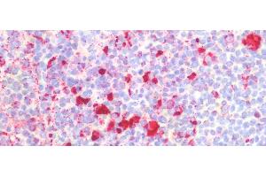 Detection of PSAP in Human Spleen Tissue using Polyclonal Antibody to Prosaposin (PSAP)