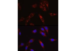 Immunofluorescence analysis of U2OS cells using SECISBP2 Rabbit pAb (ABIN6128699, ABIN6147497, ABIN6147498 and ABIN6222461) at dilution of 1:50 (40x lens).