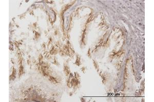 Immunoperoxidase of monoclonal antibody to ABCC4 on formalin-fixed paraffin-embedded human prostate.
