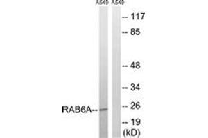 Western blot analysis of extracts from A549 cells, using RAB6A Antibody. (RAB6A anticorps  (AA 113-162))