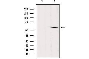 Western blot analysis of extracts from rat brain, using PSAP Antibody.