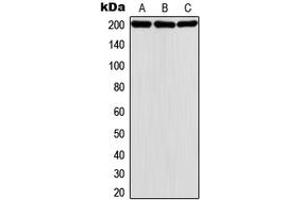 Western blot analysis of MADD expression in HeLa (A), A431 (B), K562 (C) whole cell lysates. (MADD anticorps  (Center))
