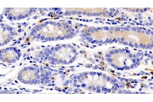 Detection of IL22R in Human Small intestine Tissue using Polyclonal Antibody to Interleukin 22 Receptor (IL22R) (IL22 Receptor alpha 1 anticorps  (AA 267-565))