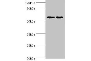Western blot All lanes: Diacylglycerol kinase epsilon antibody at 5 μg/mL Lane 1: Rat brain tissue Lane 2: Hela whole cell lysate Secondary Goat polyclonal to rabbit IgG at 1/10000 dilution Predicted band size: 64, 21 kDa Observed band size: 64 kDa (DGKE anticorps  (AA 40-260))