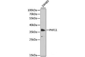 Western blot analysis of extracts of SW480 cells using PHF11 Polyclonal Antibody at dilution of 1:1000.