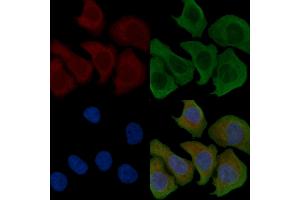 ABIN6258241 and ABIN6274503 staining Hela cells by IF/ICC.