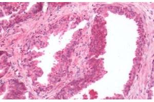 Human Prostate: Formalin-Fixed, Paraffin-Embedded (FFPE)
