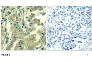 Image no. 1 for anti-Phospholipase C gamma 2 (PLCG2) (Tyr1217) antibody (ABIN319402) (Phospholipase C gamma 2 anticorps  (Tyr1217))