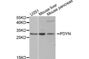Western blot analysis of extracts of various cell lines, using PDYN antibody. (PDYN anticorps)