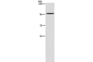 Western Blot analysis of A172 cell using PDE6C Polyclonal Antibody at dilution of 1:1400 (PDE6C anticorps)