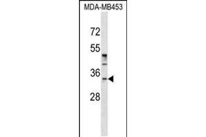 Western blot analysis in MDA-MB453 cell line lysates (35ug/lane). (POU6F1 anticorps  (N-Term))