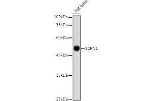 Western blot analysis of extracts of Rat brain , using SCRN1 antibody (ABIN7270175) at 1:1000 dilution.