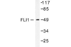 Image no. 1 for anti-Friend Leukemia Virus Integration 1 (FLI1) antibody (ABIN265422) (FLI1 anticorps)