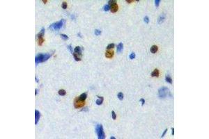 Immunohistochemical analysis of ZFP95 staining in human brain formalin fixed paraffin embedded tissue section.