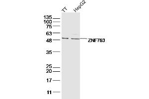 Lane 1: TT lysates Lane 2: hepg2 lysates probed with ZNF763 Polyclonal Antibody, Unconjugated  at 1:300 dilution and 4˚C overnight incubation. (ZNF763 anticorps  (AA 301-394))