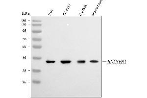 Western blot analysis of RNASEH1 using anti-RNASEH1 antibody (ABIN7602317).