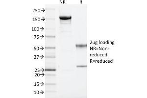 SDS-PAGE Analysis Purified ARF1 Mouse Monoclonal Antibody (ARF1/2117). (ARF1 anticorps)