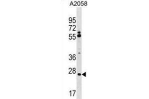 Western Blotting (WB) image for anti-Canopy 3 Homolog (CNPY3) antibody (ABIN5019952) (TNRC5 anticorps)