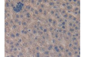 DAB staining on IHC-P; Samples: Rat Liver Tissue (CTGF anticorps  (AA 25-347))