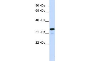 WB Suggested Anti-NFKBIA Antibody Titration:  0. (NFKBIA anticorps  (Middle Region))