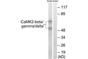 Western blot analysis of extracts from rat brain cells, using CaMK2-beta/gamma/delta (Ab-287) Antibody. (CaMK2 beta/gamma/delta (AA 253-302) anticorps)