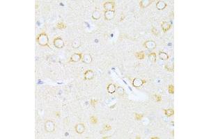 Immunohistochemistry of paraffin-embedded rat brain using Casp8 antibody. (Caspase 8 anticorps)