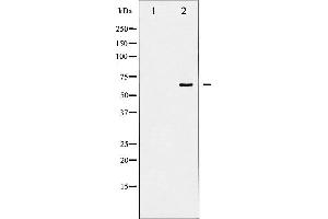 Western blot analysis of Shc phosphorylation expression in EGF treated 293 whole cell lysates,The lane on the left is treated with the antigen-specific peptide.