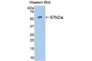 Western blot analysis of the recombinant protein. (ALDH7A1 anticorps  (AA 29-539))