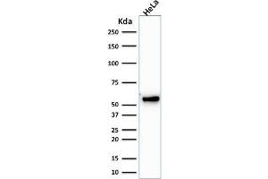 Western Blot Analysis of human HeLa cell lysate using Cytokeratin 7 Mouse Monoclonal Antibody (KRT7/1198). (Cytokeratin 7 anticorps)