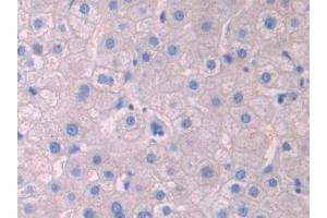 Detection of LCAT in Human Liver Tissue using Polyclonal Antibody to Lecithin Cholesterol Acyltransferase (LCAT) (LCAT anticorps  (AA 290-433))