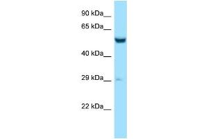 Western Blotting (WB) image for anti-Zinc Finger CCCH-Type Containing 10 (ZC3H10) (N-Term) antibody (ABIN2788533) (ZC3H10 anticorps  (N-Term))