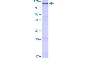 Image no. 1 for Discoidin Domain Receptor tyrosine Kinase 2 (DDR2) (AA 1-855) protein (GST tag) (ABIN1351300)