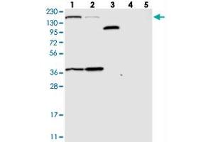 Western blot analysis of Lane 1: RT-4, Lane 2: U-251 MG, Lane 3: Human Plasma, Lane 4: Liver, Lane 5: Tonsil with SAMD9 polyclonal antibody  at 1:250-1:500 dilution. (SAMD9 anticorps)