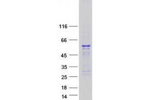 Validation with Western Blot