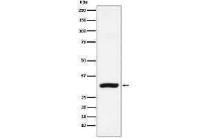 Western blot analysis of CBR1 expression in MCF-7 cell lysate.